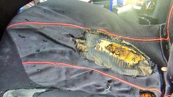 Woman badly burned after vaping device explodes, officials say