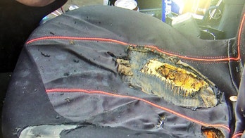 Virginia woman severely burned in vape device explosion: report