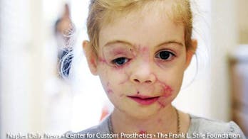 Docs join to help girl attacked by dogs after KFC hoax accusations