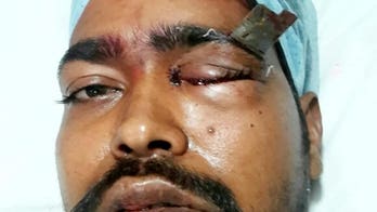 Graphic warning: Man survives being stabbed in eye, knife misses his brain by millimeters
