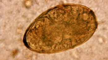 Lung worm infections on the rise, CDC says