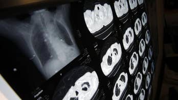 Many patients unaware of risks that go with some medical scans