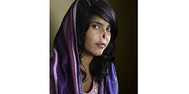 World Press Photo of the Year 2010 shows Bibi Aisha, an 18-year-old woman from Oruzgan province, Afghanistan.