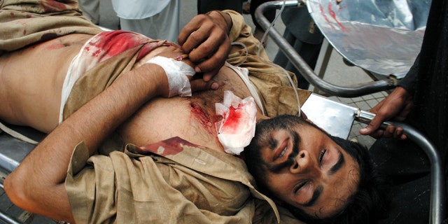 March 31: A person injured by a roadside bombing is rushed to a local hospital in Peshawar, Pakistan.