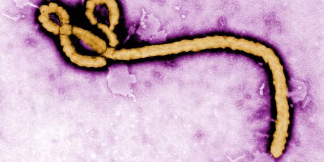 This undated colorized transmission electron micrograph image made available by the CDC shows an Ebola virus virion.