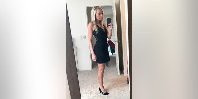 The executive assistant was mocked in high school for her disability and became obsessed with concealing her leg.