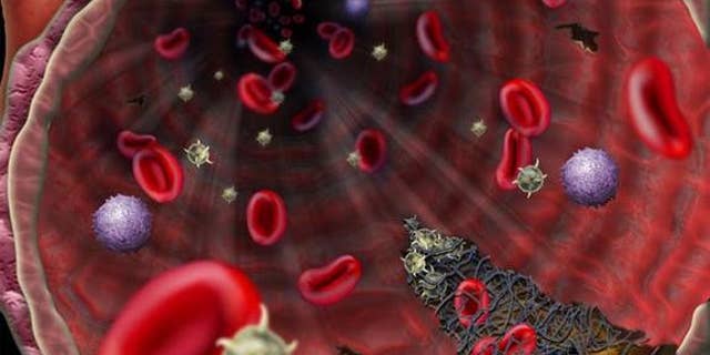 People with the rare Vel-negative blood type can die if they receive a Vel-positive transfusion, and now scientists know why.