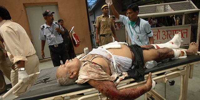 September 7: A man injured in bomb blast is brought to the RML hospital in New Delhi, India.
