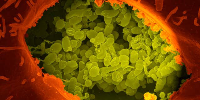 This undated image provided by the National Institute of Allergy and Infectious Diseases on Wednesday, Sept. 30, 2015 shows a Vero cell containing Coxiella burnetii bacteria which causes Q fever in humans.