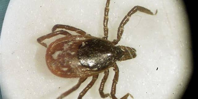 This file photo shows a deer tick under a microscope in the entomology lab at the University of Rhode Island in South Kingstown, RI.