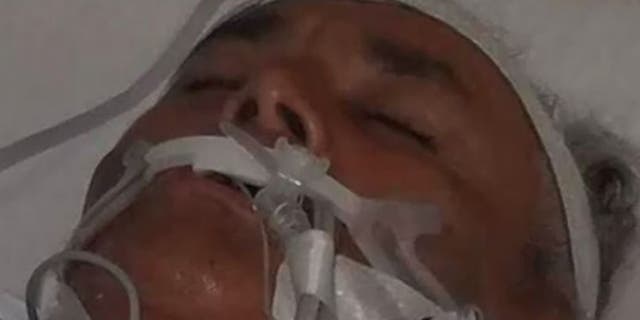 Perez has been hospitalized for over a month since he contracted the flesh-eating bacteria.