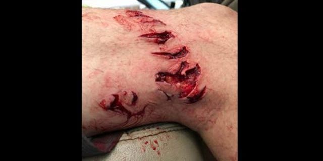 Blaine Shelton was attacked by a shark while swimming near Crystal Beach.
