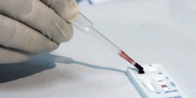 File photo of a health agent using a new test kit that rapidly diagnoses three different mosquito-borne viruses in Sao Paulo, Brazil, January 18, 2016. REUTERS/Rodrigo Paiva