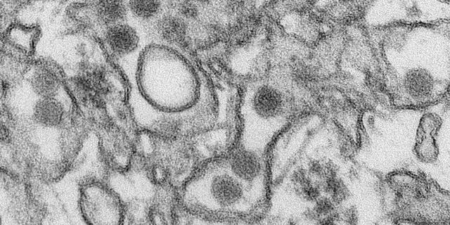 A transmission electron micrograph (TEM) shows the Zika virus, in an undated photo provided by the Centers For Disease Control in Atlanta, Georgia. REUTERS/CDC/Cynthia Goldsmith/Handout via Reuters