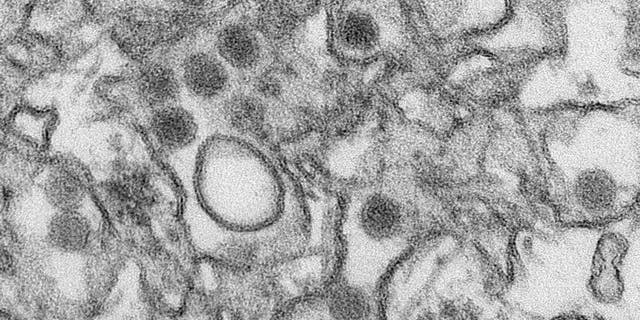 A transmission electron micrograph (TEM) shows the Zika virus, in an undated photo provided by the Centers For Disease Control in Atlanta, Georgia. REUTERS/CDC/Cynthia Goldsmith/Handout via Reuters
