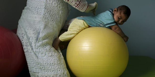 Physiotherapist Leal does exercises with Lucas, 4-months old, who is Miriam Araujo's second child and born with microcephaly in Pedro I hospital in Campina Grande