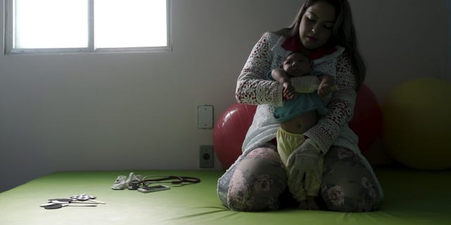Physiotherapist Leal does exercises with Lucas, 4-months old, who is Miriam Araujo's second child and born with microcephaly in Pedro I hospital in Campina Grande