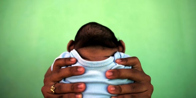 A 4-month-old baby born with microcephaly is held by his mother in front of their house in Olinda