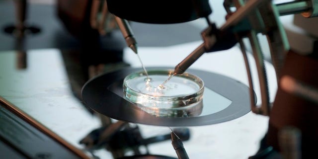 Doctor Katarzyna Koziol injects sperm directly into an egg during IVF procedure called Intracytoplasmic Sperm Injection at Novum clinic in Warsaw