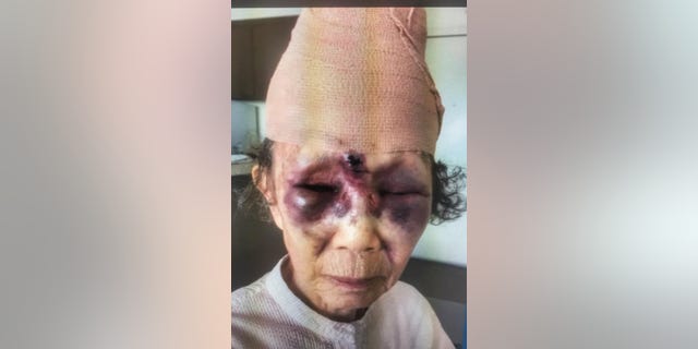 Mi Reum Song, 86, was attacked Saturday afternoon and suffered head injuries.