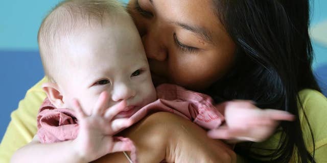 Aug. 3, 2014: Pattaramon Chanbua, right, kisses her baby boy Gammy at a hospital in Chonburi province, southeastern Thailand. (AP)