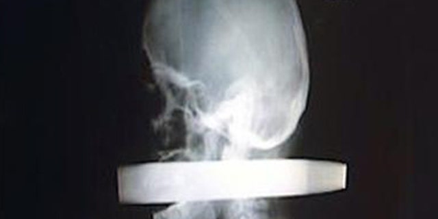 Andrew Linn's X-ray
