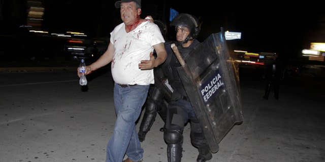 An injured protester is taken into custody by police during a protest demanding better labor conditions for teachers in Acapulco, Mexico, late Tuesday, Feb. 24, 2015. Police clashed with union members representing teachers and other public workers who were blocking the airport. Demonstrators also protested the Sept. 26, 2014 disappearance of 43 students in Guerrero state. (AP Photo/Bernandino Hernandez)