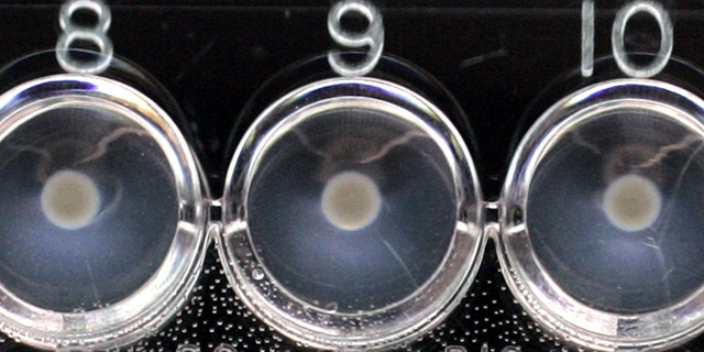 FILE - In this Sept. 29, 2006, file photo, an E. coli screening test for "O" antigens is seen in the Gastroenteric Disease Center at Pennsylvania State University's Wiley Lab in State College, Pa. (AP Photo/Carolyn Kaster, File)