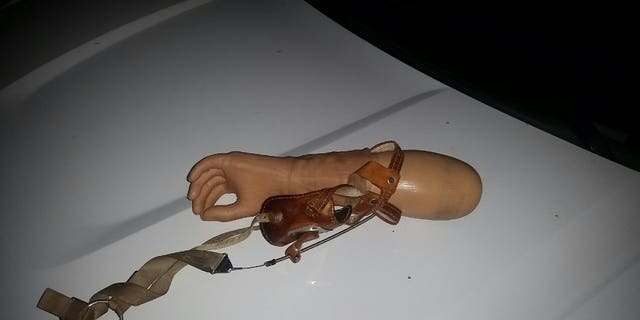Investigators in California were pointed in the right direction when a prosthetic arm that was reported stolen last week was spotted in the alleged thieves' car.