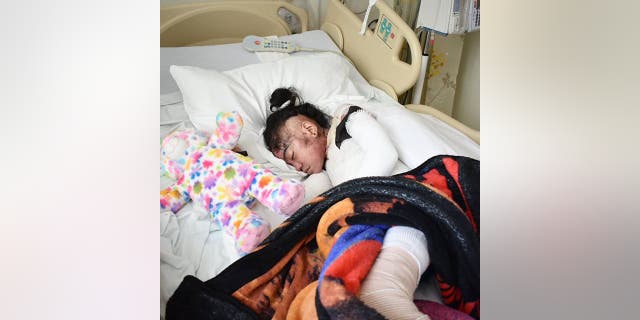 Destiny was born with a rare condition that causes her fragile skin to blister.