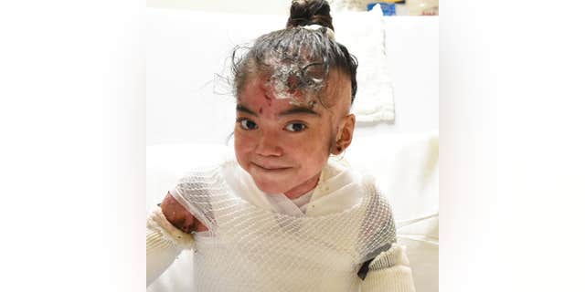 “I don’t remember a day without pain,” Destiny said of her life with the genetic tissue disorder epidermolysis bullosa (EB).