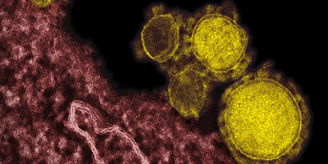 This electron microscope image shows the MERS virus, colorized in yellow. The mysterious new respiratory virus that originated in the Middle East spreads easily between people and appears more deadly than SARS, doctors reported.