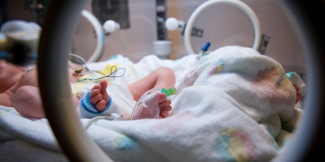 A premature infant in the NICU.