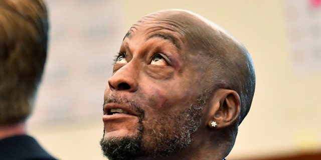 In this July, 9, 2018, file photo, plaintiff DeWayne Johnson looks up during a brief break as the Monsanto trial in San Francisco.