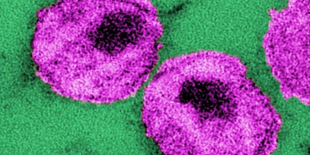 HIV, or human immunodeficiency virus, particles in purple, cause the disease AIDS. Credit: CDC/ Dr. A. Harrison; Dr. P. Feorino