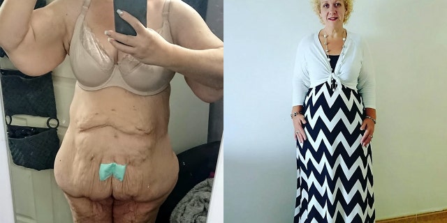 A woman who lost 252 pounds says she's been rejected by multiple men on Tinder after sending them pics of her excess skin.