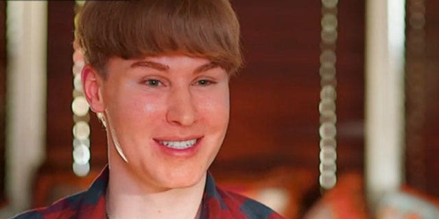 Botched Patient Who Tried To Look Like Justin Bieber Is Missing 