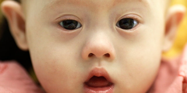 Gammy, a baby born with Down's Syndrome, is held by his surrogate mother Pattaramon Janbua (not seen) at a hospital in Chonburi province August 3, 2014. According to Pattaramon, his Australian parents, through a local surrogate agency, asked her at her 7th month of pregnancy to terminate it because of his Down's Syndrome but she refused and kept the baby. The Australian parents instead took with them Gammy's twin sister who was born healthy. More than 3 million Thai baht ($93,360) was raised through an online campaign in Thailand in less than a day for the medical treatment of Gammy who suffers from potentially life threatening heart conditions and a serious lung infection, local media reported. REUTERS/Damir Sagolj (THAILAND - Tags: SOCIETY HEALTH) - RTR411O6