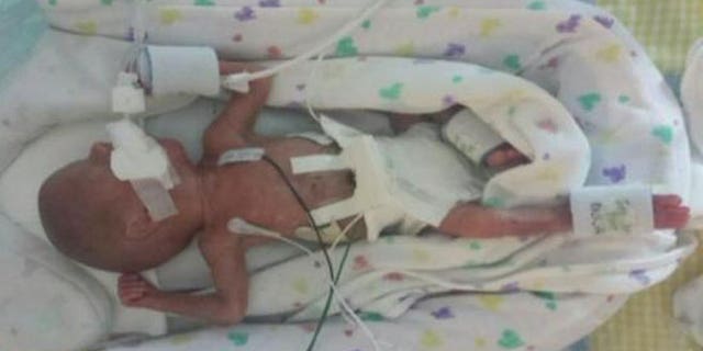 Link Gorveatt, pictured here, was born extremely premature at 23 weeks old on Tuesday, Sept. 29. He and his twin brother, Logan, suffered from twin-to-twin transfusion syndrome, a condition marked by a shared placenta in utero.