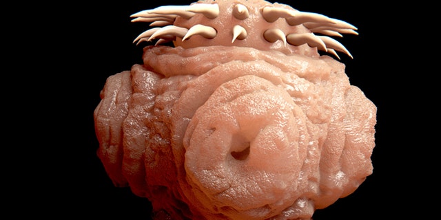 A look at a tapeworm under a microscope.