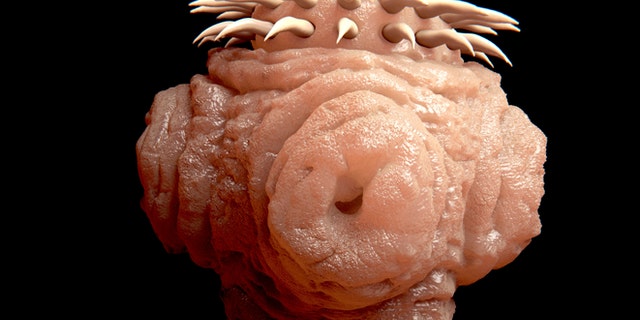A look at a tapeworm under a microscope.