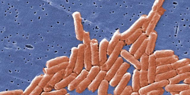 This colorized scanning electron micrograph (SEM) depicts a colony of rod-shaped Salmonella sp. bacteria