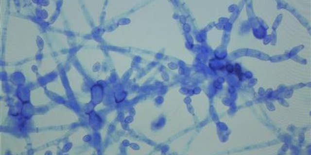 A sample of Cladosporium species, one of the fungi diagnosed in the fungal meningitis outbreak sweeping the United States. REUTERS/Harrison McClary