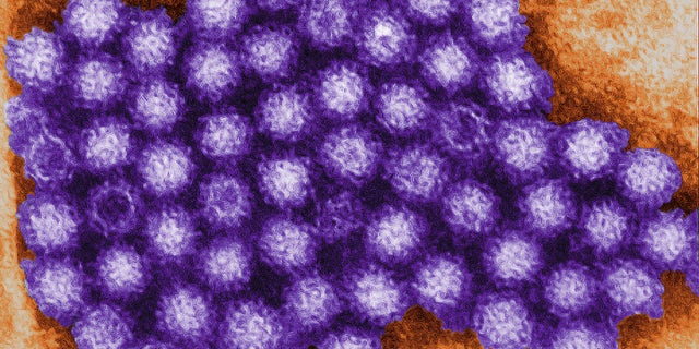 This transmission electron micrograph (TEM) reveals norovirus virions, or virus particles.