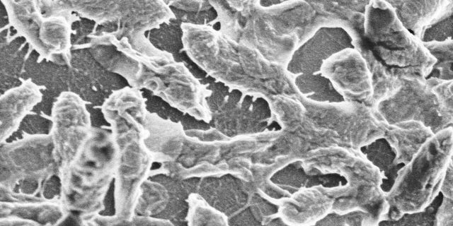 This image provided by UTMB-Galveston shows a scanning electron microscopic image of WT (wild type) Aeromonas hydrophila strain SSU, the bacteria responsible for the flesh-eating disease that is usually caused by a strep germ. Georgia grad student Aimee Copeland is fighting a life-threatening flesh-eating disease, and doctors are calling her case very rare. The infection occurred after she gashed her leg in a Georgia river May 1, 2012, after a zip line accident. (AP Photo/UTMB-Galveston, Ashok K. Chopra, Ph.D., and Dr. Leon Bromberg)