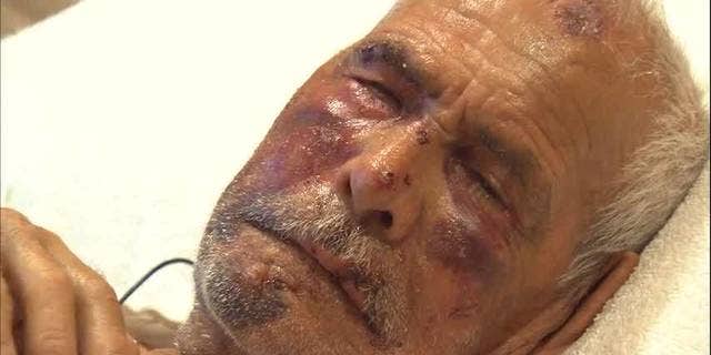 Rodolfo Rodriguez, 92, was beaten in the face with a break and stomped on during an attack on July 4.