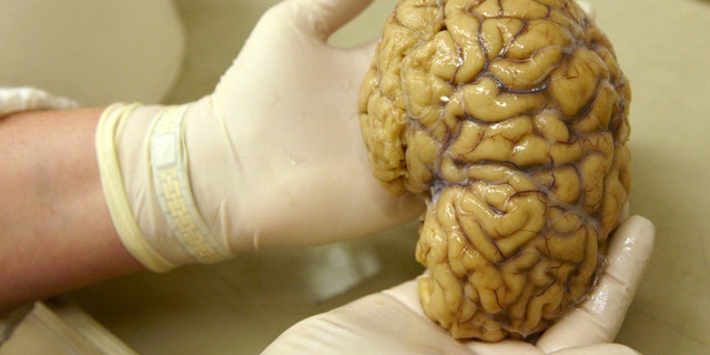 File photo - A laboratory assistant holds one hemisphere of a healthy brain in the Morphological unit of psychopathology in the Neuropsychiatry division of the Belle Idee University Hospital in Chene-Bourg near Geneva in a March 14, 2011 file photo. (REUTERS/Denis Balibouse/files)