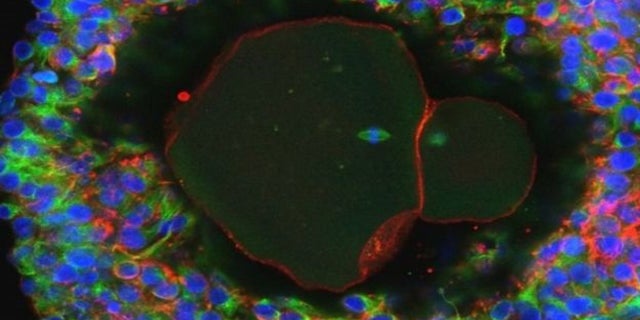A human egg grown and developed by scientists at the University of Edinburgh. Doctor David Albertini generated the image, and Professor Evelyn Telfer led the research.