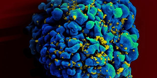 FILE - This April 12, 2011 electron microscope image made available by the National Institute of Allergy and Infectious Diseases shows an H9 T cell, blue, infected with the human immunodeficiency virus (HIV), yellow. Research suggests that a shot every one to three months may someday give an alternative to the daily pills that some people take now to cut their risk of getting HIV from sex with an infected partner. An experimental drug given in periodic shots completely protected monkeys from infection in two studies reported at an AIDS conference on Tuesday, March 4, 2014. (AP Photo/NIAID)