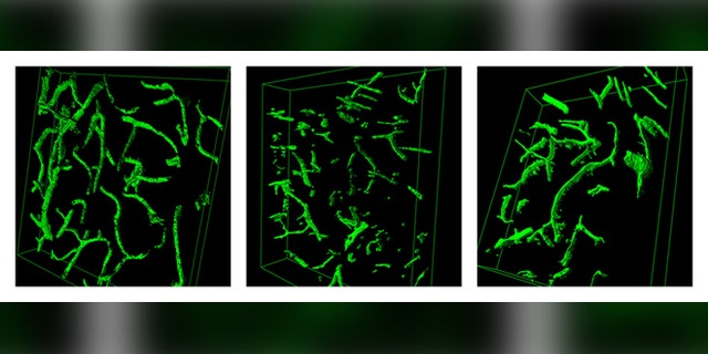 This combination of images shows 3-D reconstructions of brain blood vessels in, from left, a young mouse, an old mouse, and an old mouse who was exposed to the blood of a young mouse. (AP Photo/Lida Katsimpardi)